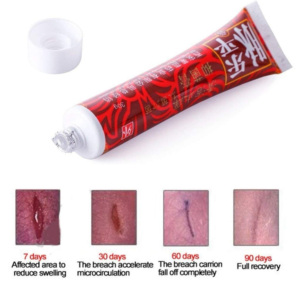 VEINS TREATMENT CREAM